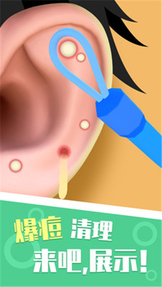 你是來(lái)掏耳屎的吧